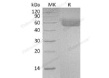 Recombinant Human IL1R1/CD121a Protein