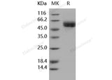 Recombinant Human IL1R1/CD121a Protein (His Tag)(Active)