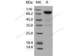 Recombinant Human IL1R1/CD121a Protein (Fc Tag)(Active)