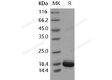 Recombinant Human IL36G/IL1F9 Protein (aa 18-169, His Tag)