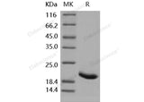 Recombinant Human IL-1RA/IL1RN Protein (Active)