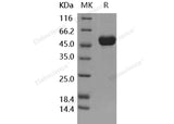 Recombinant Human IL-1RA/IL1RN Protein (Fc Tag)