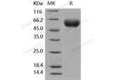 Recombinant Human IL-1RAcP/IL-1R3 Protein (His Tag)