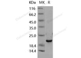 Recombinant Human DUSP3/VHR Protein (Active)