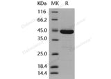 Recombinant Human DUSP3/VHR Protein (His & GST Tag)