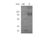 Recombinant Human VCAM1 Protein (Fc Tag)(Active)