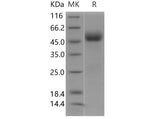 Recombinant Human IL1R2/CD121b Protein (Active)