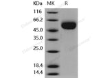 Recombinant Human IL1R2/CD121b Protein (His Tag)(Active)