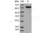 Recombinant Human IL1R2/CD121b Protein (Fc Tag)(Active)