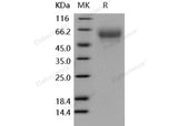 Recombinant Human CD155/PVR Protein (His Tag)(Active)