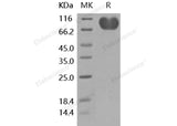 Recombinant Human CD155/PVR Protein (Fc Tag)(Active)