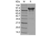 Recombinant Human Carbonic Anhydrase 9/CA9 Protein (Fc Tag)(Active)