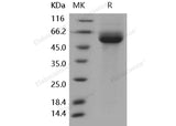 Recombinant Human IL1RL1/ST2 Protein (His Tag)(Active)