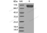 Recombinant Human IL1RL1/ST2 Protein (Fc Tag)(Active)