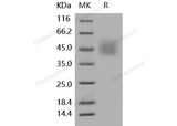 Recombinant Human CD34 Protein (His Tag)