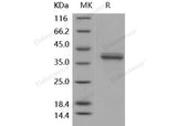 Recombinant Human Cathepsin L2/CTSL2 Protein (His Tag)(Active)