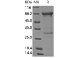 Recombinant Human MMP-2 Protein (Active)