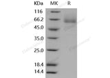 Recombinant Human Glypican 5/GPC5 Protein (His Tag)(Active)