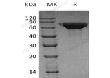 Recombinant Human CNDP1 Protein (His Tag)(Active)