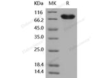 Recombinant Human CD14 Protein (Fc Tag)