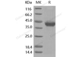 Recombinant Human AgRP/AGRP Protein (Fc Tag)