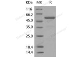 Recombinant Human Carboxypeptidase E/CPE Protein (His Tag)(Active)