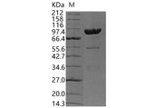 Recombinant Human Carboxypeptidase E/CPE Protein (Fc Tag)