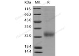 Recombinant Human ALK-1/ACVRL1 Protein (His Tag)(Active)