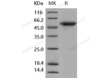 Recombinant Human ALK-1/ACVRL1 Protein (Fc Tag)(Active)