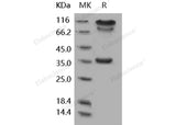 Recombinant Human BACE1/ASP2 Protein (Fc Tag)(Active)