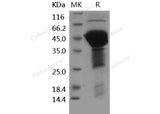 Recombinant Human MAPT/Tau Protein (His Tag)