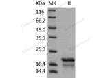 Recombinant Human NPM1/Nucleophosmin Protein (His Tag)