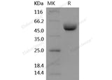 Recombinant Human ANPEP/CD13 Protein (603 Met/Ile, His Tag)(Active)