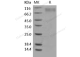 Recombinant Human TrkC/NTRK3 Protein (His Tag)(Active)