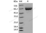 Recombinant Human ALCAM/CD166 Protein (His Tag)(Active)