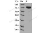 Recombinant Human 2B4/CD244 Protein (Fc Tag)(Active)