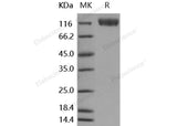 Recombinant Human VEGFR2/Flk-1/KDR Protein (His Tag)(Active)