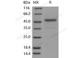 Recombinant Human CD112/Nectin-2 Protein (Active)