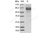 Recombinant Human LILRB4/CD85k/ILT3 Protein (aa 1-257, Fc Tag)