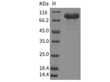 Recombinant Human beta Amylase/AMY2 Protein (Fc Tag)