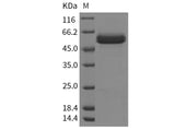 Recombinant Human beta Amylase/AMY2 Protein (His Tag)