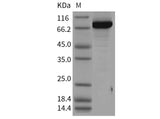 Recombinant Human PBEF/NAMPT Protein (His & GST Tag)