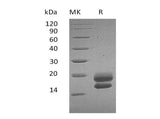 Recombinant Human VEGF-A/VEGF121 Protein (His Tag)