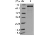 Recombinant Human Interleukin-35/IL-35 Protein (Fc Tag)(Active)