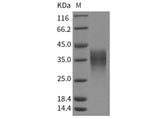 Recombinant Human LIF Protein (HEK293 Cells)(Active)