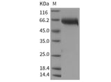 Recombinant Human LIF Protein (Fc Tag)(Active)