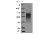 Recombinant Human LIF Protein (His Tag)(Active)