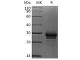 Recombinant Human VEGF-C/VEGFC Protein (His Tag)