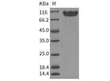 Recombinant Human NCAM1 Protein (ECD, His Tag)