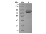 Recombinant Human Osteopontin/SPP1 Protein (His Tag)